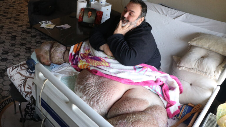 kayseride-fil-hastasi-adam-300-kiloya-ulasti-5-yildir-disari-cikamiyor-5JDvZlwf.jpg